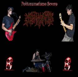 Corpus Mors : Politraumatismo Severo Corpus Mors : Politraumatismo Severo